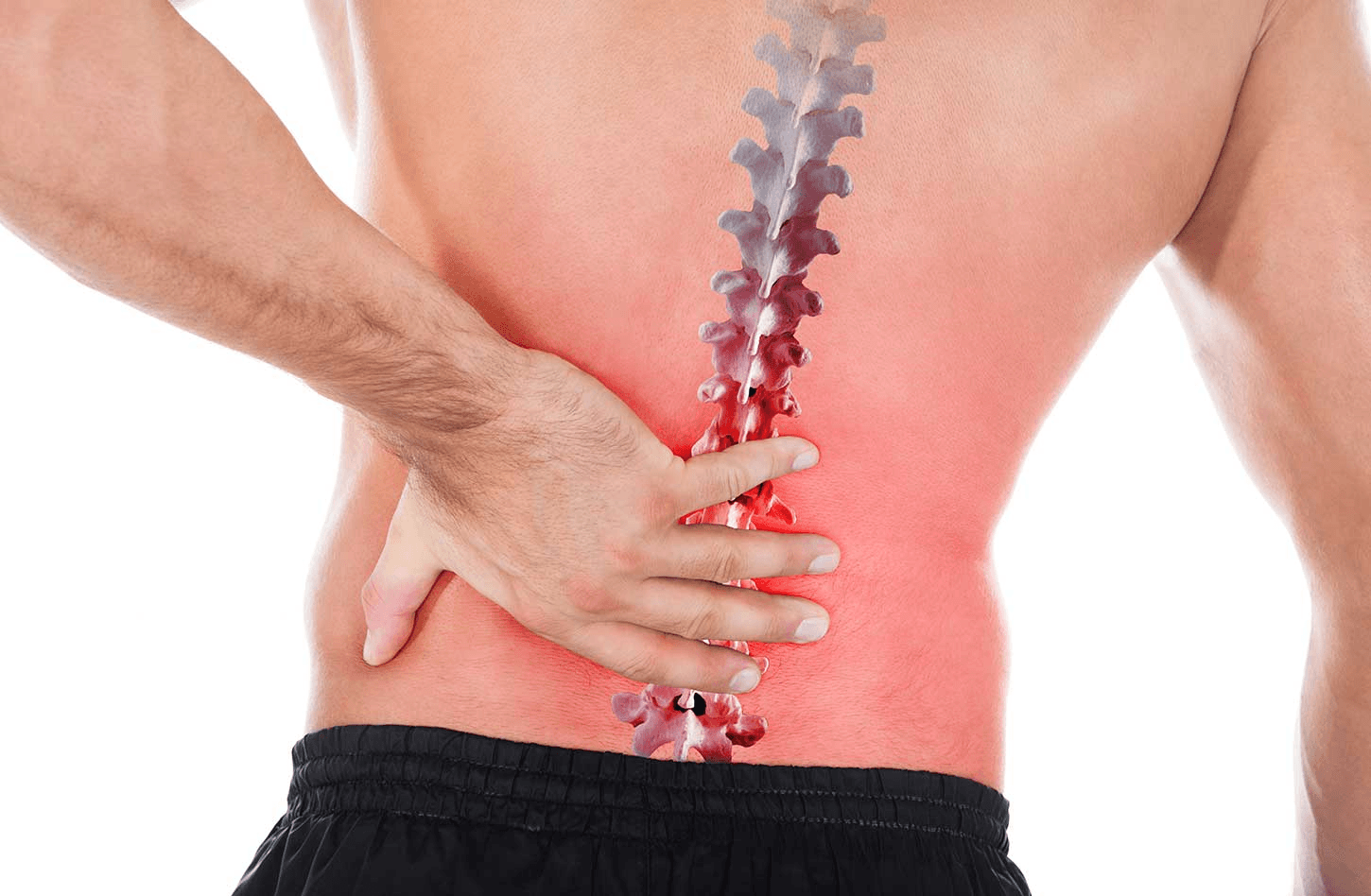 Disc Herniation